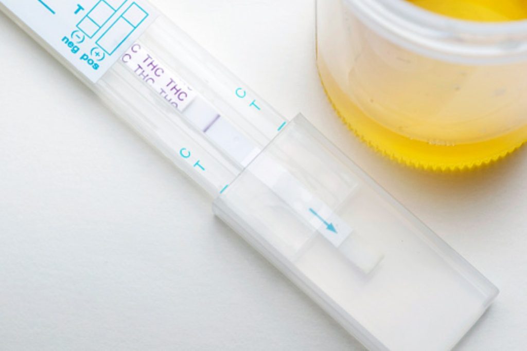 Urine Drug Tests