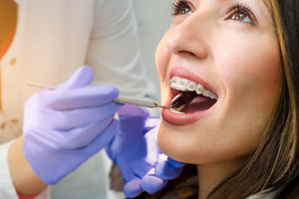 Teeth Alignment Success: 6 Tips For Effective Orthodontics